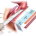 Qual é a Profundidade de uma Vagina