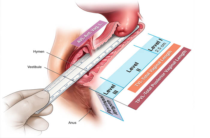 Qual é a Profundidade de uma Vagina